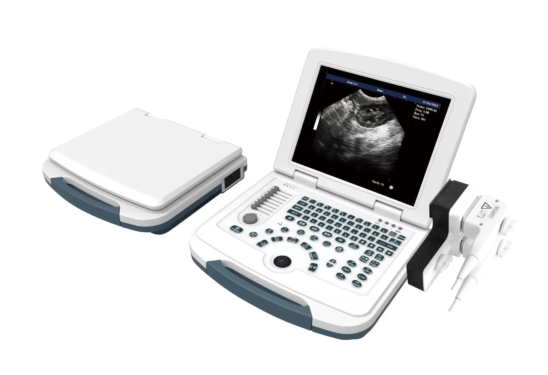 VU10 Laptop Veterinary Ultrasound